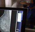 Entidades alertam médicos sobre pedidos de mamografia digital