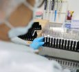 Malária: Anvisa autoriza teste em humanos de vacina 100% brasileira